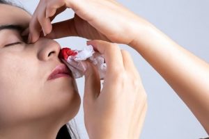 Chảy máu cam và bệnh lý nguy hiểm