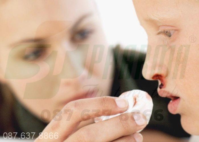 Nguyên nhân chảy máu cam