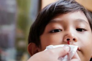 [Có thể bạn chưa biết?] Chảy máu cam là thiếu chất gì?