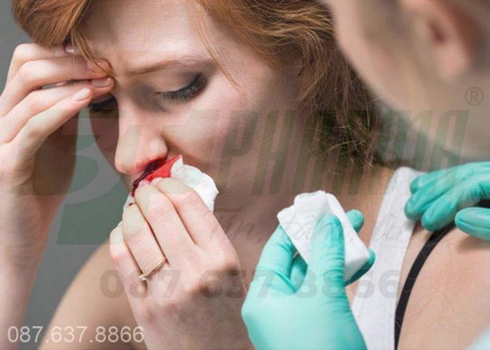 Chảy máu cam hay chính là tình trạng xuất huyết ở mũi 