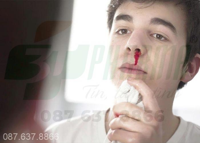 Chảy máu cam nhiều lần trong ngày nên làm gì, nguyên nhân chảy máu cam