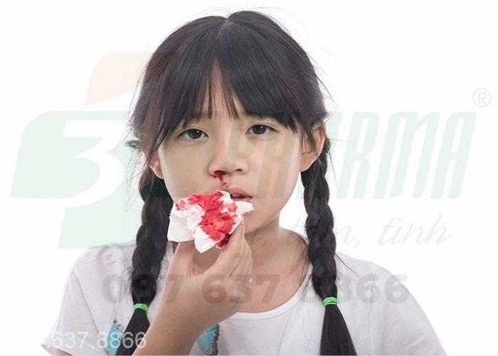 Dấu hiệu chảy máu cam quá nhiều, chảy máu cam nhiều lần trong ngày nên làm gì