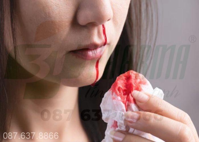 chảy máu cam nhiều lần trong ngày nên làm gì? Bổ sung thực phẩm bổ dưỡng giàu sắt