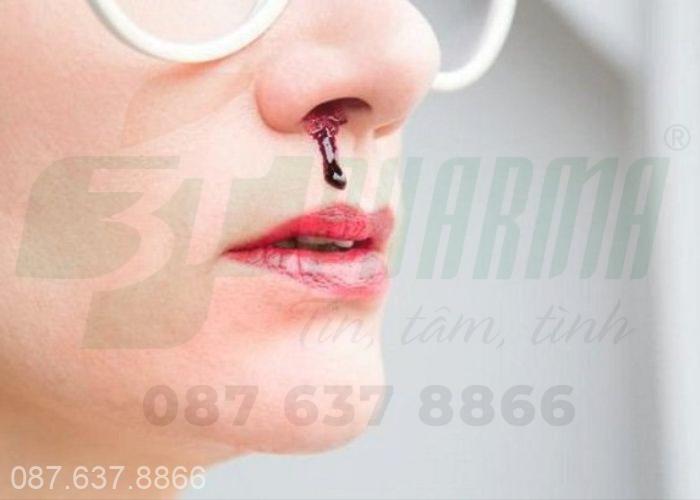 Chảy máu cam nếu xảy ra thường xuyên thì bạn cần đi khám và có hướng điều trị