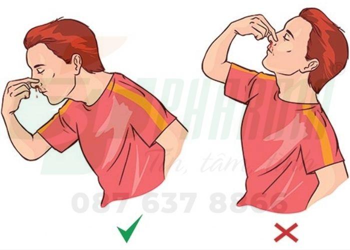 Cách xử trí chảy máu cam 