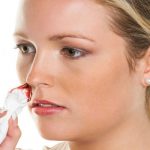 Tình trạng chảy máu cam ở người lớn là bệnh gì?