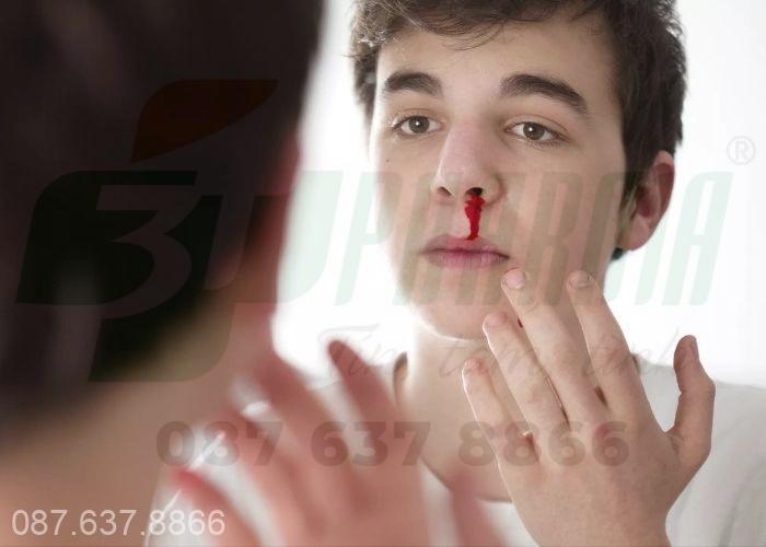 Chảy máu cam ở người lớn sẽ không nguy hiểm nếu không có kèm theo các dấu hiệu bệnh lý 