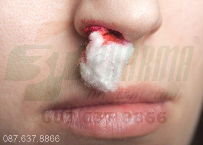 Trẻ bị chảy máu cam khi ngủ, chảy máu cam ở trẻ em vào ban đêm