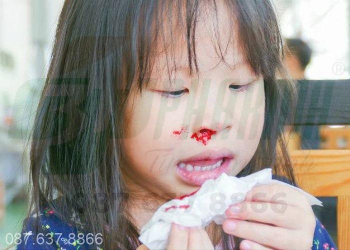 Chảy máu cam do khô mũi, chảy máu cam ở trẻ em vào ban đêm