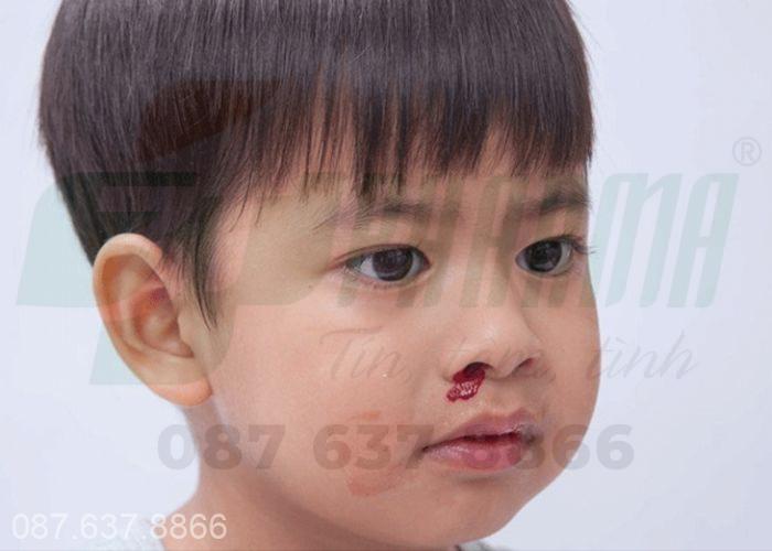 Tình trạng chảy máu cam ở trẻ em vào ban đêm là do nguyên nhân thiếu hụt chính khí