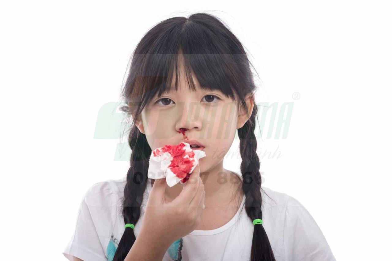 mũi chảy máu cam là bệnh gì