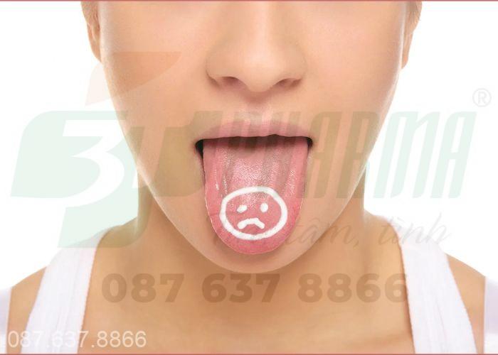 Nhiệt lưỡi là tình trạng niêm mạc lưỡi bị tổn thương do viêm, loét 
