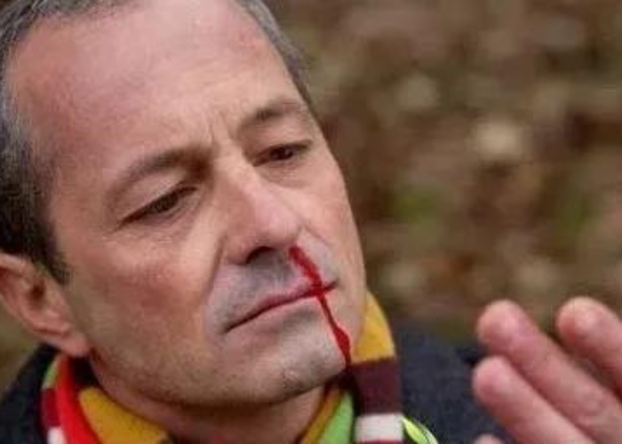 Chảy máu cam ở người già