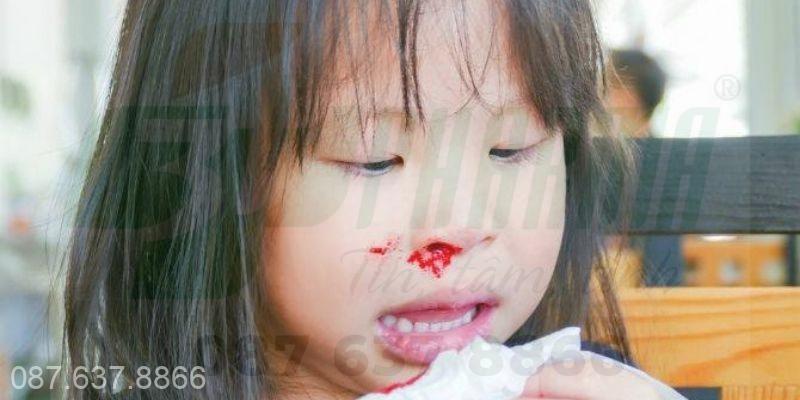 Chảy máu cam khiến nhiều người lo lắng