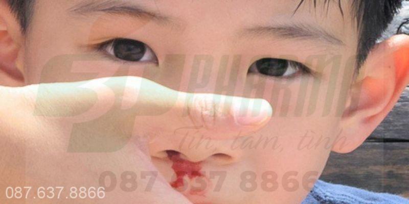 Cách xử lý chảy máu cam