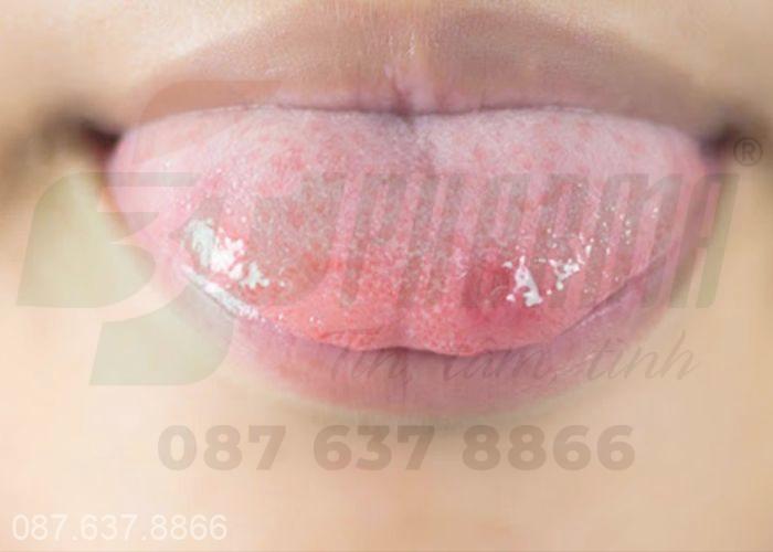 Hình ảnh nhiệt lưỡi