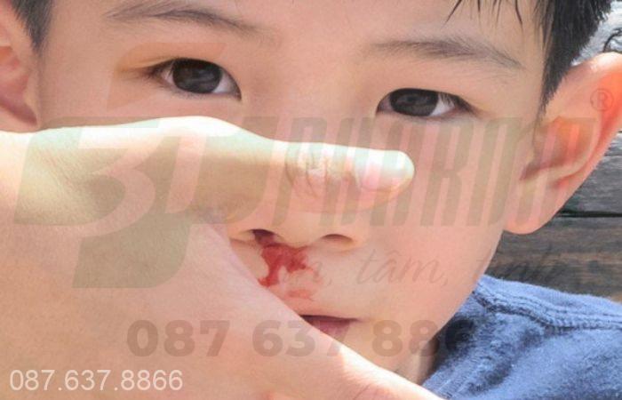 Nguyên nhân trẻ bị chảy máu cam