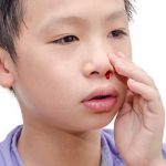 Trẻ nằm điều hoà bị chảy máu cam