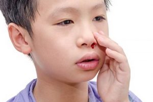 Trẻ nằm điều hoà bị chảy máu cam
