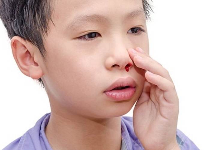 Trẻ nằm điều hoà bị chảy máu cam