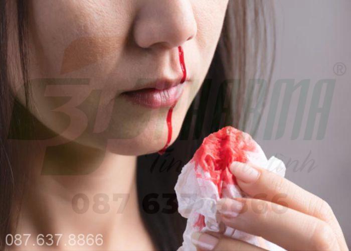 Triệu chứng chảy máu cam
