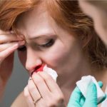 Chảy máu cam và bệnh lý về mũi