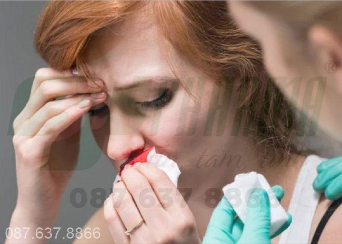 Chảy máu cam và bệnh lý về mũi