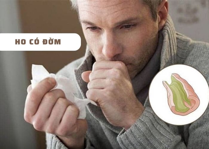 Ho có đờm là dấu hiệu điển hình của viêm phế quản