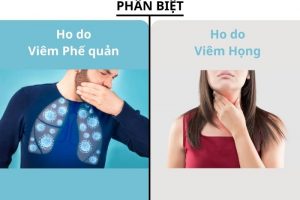 Cần phân biệt ho do viêm phế quản và ho do viêm họng để có cách điều trị phù hợp