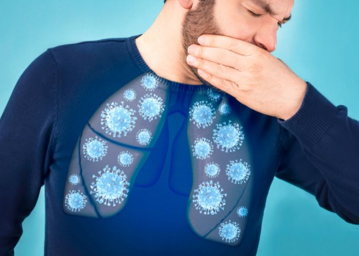 Ho, khạc đờm, mệt mỏi là triệu chứng đặc trưng của viêm phế quản bội nhiễm