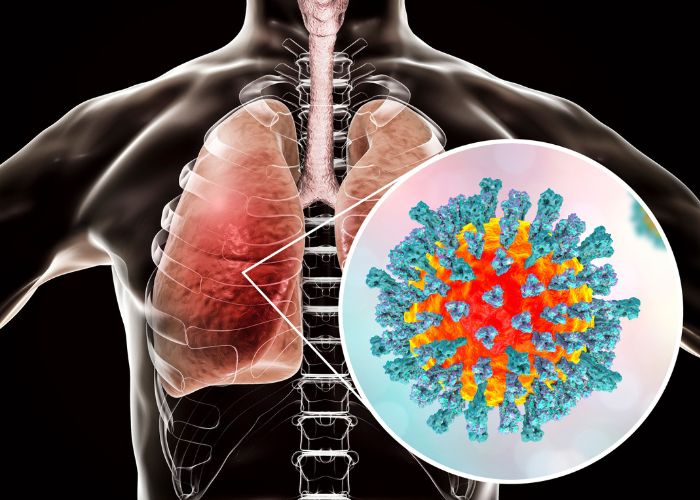 Virus, vi khuẩn xâm nhập, tấn công cơ thể gây viêm phế quản bội nhiễm