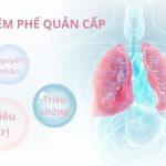 viêm phế quản cấp