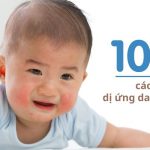 cách trị dị ứng da mặt