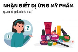 dấu hiệu dị ứng mỹ phẩm