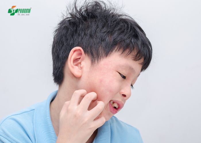 Dị ứng cơ địa khiến trẻ nhỏ ngứa ngáy, khó chịu