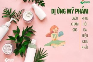 Dị ứng mỹ phẩm thường gặp ở phụ nữ