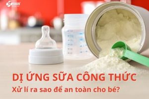 Dị ứng sữa công thức thường gặp ở trẻ nhỏ, trẻ sơ sinh
