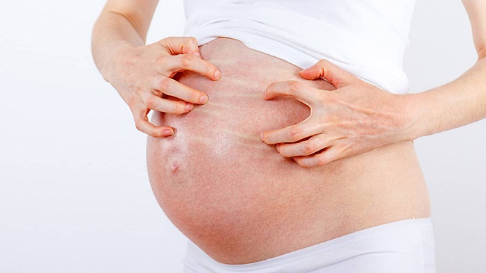 Dị ứng khi mang thai là tình trạng khá phổ biến