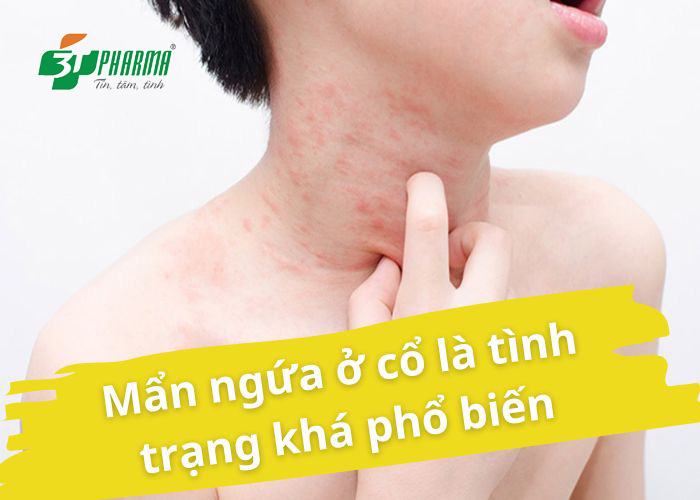 Mẩn ngứa ở cổ là tình trạng khá phổ biến