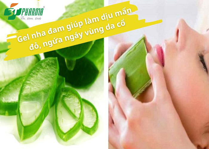 Gel nha đam giúp làm dịu mẩn đỏ, ngứa ngáy vùng da cổ