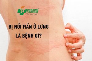 Bị nổi mẩn ngứa ở lưng