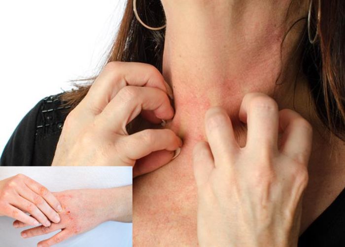 Da khô gây ngứa ngáy khó chịu, đặc biệt khi trời hanh khô