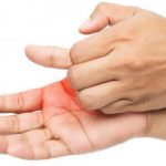 Ngứa râm ran khắp người nhưng không nổi mẩn