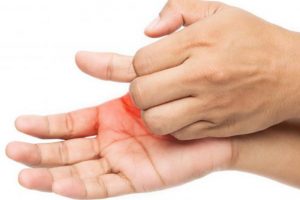 Ngứa râm ran khắp người nhưng không nổi mẩn