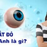 benh dau mat do tieng anh la gi