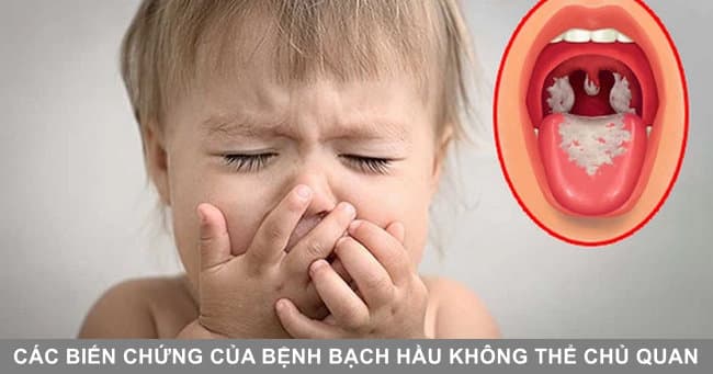 bien chung cua benh bach hau