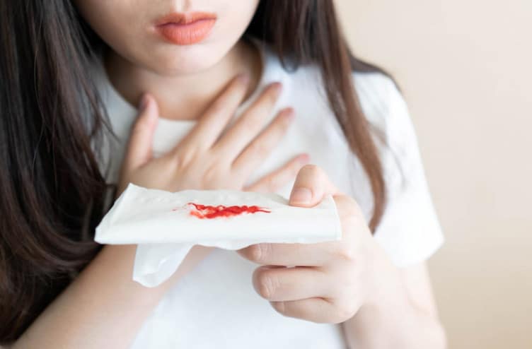 Các bệnh ho ra máu