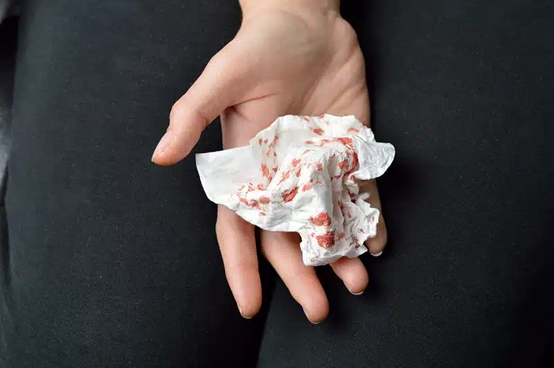 Triệu chứng bệnh ho ra máu